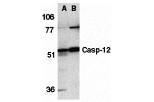 Western Blotting (WB) image for anti-Caspase 12 (Gene/pseudogene) (CASP12) (N-Term) antibody (ABIN1031295) (Caspase 12 anticorps  (N-Term))