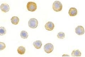 Immunocytochemistry of IL-1RAcP in HeLa cells with AP30412PU-N IL-1RAcP antibody at 5 μg/ml.