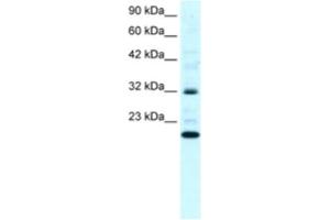 Western Blotting (WB) image for anti-rho GDP Dissociation Inhibitor (GDI) gamma (ARHGDIG) antibody (ABIN2460825) (ARHGDIG anticorps)
