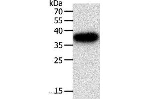 Western blot analysis of A549 cell, using PLAUR Polyclonal Antibody at dilution of 1:400 (PLAUR anticorps)