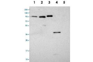 Western blot analysis of Lane 1: RT-4, Lane 2: U-251 MG, Lane 3: Human Plasma, Lane 4: Liver, Lane 5: Tonsil with CCDC19 polyclonal antibody  at 1:100-1:250 dilution. (CCDC19 anticorps)