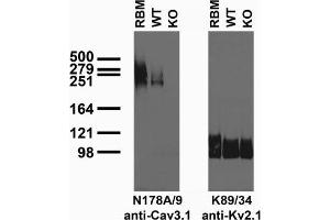 Immunoblot of crude brain membranes from adult rat (RBM) and Cav3. (Cav3.1 Ca2+ Channel (AA 2052-2172), (C-Term), (Cytosolic) anticorps)