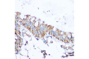 Immunohistochemistry of paraffin-embedded human colon using SIRT4 Rabbit pAb (ABIN6129330, ABIN6147796, ABIN6147797 and ABIN6223494) at dilution of 1:100 (40x lens). (SIRT4 anticorps  (AA 29-260))