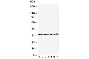 Western blot testing of Caspase-6 antibody  and Lane 1:  rat liver