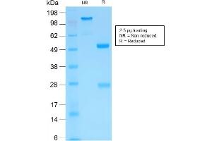 SDS-PAGE Analysis of Purified MMP3 Rabbit Recombinant Monoclonal Antibody (MMP3/1994R). (Recombinant MMP3 anticorps  (AA 317-327))