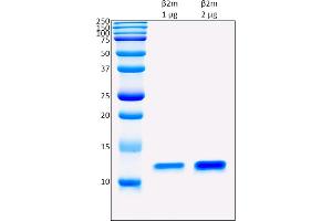 SDS-PAGE (SDS) image for beta-2-Microglobulin (B2M) protein (ABIN5675808)