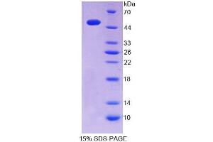Inosine Triphosphatase (ITPA) (AA 2-198) protein (GST tag,His tag)