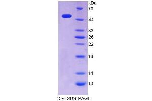 SDS-PAGE (SDS) image for Inosine Triphosphatase (ITPA) (AA 2-198) protein (GST tag,His tag) (ABIN4989338) (ITPA Protein (AA 2-198) (GST tag,His tag))
