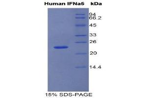 SDS-PAGE (SDS) image for Interferon, alpha 5 (IFNA5) (AA 22-189) protein (His tag) (ABIN1981197) (IFNA5 Protein (AA 22-189) (His tag))