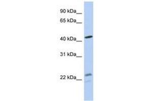 Image no. 1 for anti-Branched Chain Keto Acid Dehydrogenase E1, alpha Polypeptide (BCKDHA) (AA 71-120) antibody (ABIN6743978) (BCKDHA anticorps  (AA 71-120))