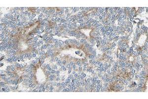 ABIN6275363 at 1/100 staining Human prostate tissue by IHC-P. (Plakophilin 4 anticorps  (N-Term))