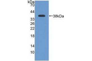 Figure. (ATR anticorps  (AA 2353-2644))