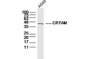 Human A549 cells probed with CRTAM Polyclonal Antibody, unconjugated  at 1:300 overnight at 4°C followed by a conjugated secondary antibody at 1:10000 for 90 minutes at 37°C. (CRTAM anticorps  (AA 31-130))