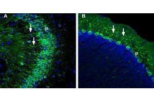 Expression of Glucose Transporter 5 in mouse hippocampus and cerebellum - Immunohistochemical staining of perfusion-fixed frozen mouse brain sections with Anti-GLUT5 (SLC2A5) Antibody (ABIN7043702, ABIN7044489 and ABIN7044490), (1:200), followed by goat-anti-rabbit-AlexaFluor-488.