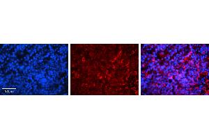 Rabbit Anti-IRF3 Antibody   Formalin Fixed Paraffin Embedded Tissue: Human Lymph Node Tissue Observed Staining: Cytoplasm Primary Antibody Concentration: 1:100 Other Working Concentrations: 1:600 Secondary Antibody: Donkey anti-Rabbit-Cy3 Secondary Antibody Concentration: 1:200 Magnification: 20X Exposure Time: 0.