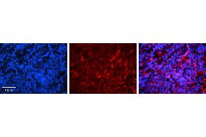 Rabbit Anti-IRF3 Antibody   Formalin Fixed Paraffin Embedded Tissue: Human Lymph Node Tissue Observed Staining: Cytoplasm Primary Antibody Concentration: 1:100 Other Working Concentrations: 1:600 Secondary Antibody: Donkey anti-Rabbit-Cy3 Secondary Antibody Concentration: 1:200 Magnification: 20X Exposure Time: 0. (IRF3 anticorps  (C-Term))