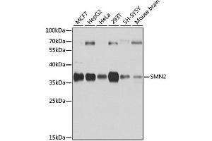 Western blot analysis of extracts of various cell lines, using SMN2 antibody. (SMN2 anticorps)