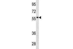 IGHD antibody western blot analysis in CEM lysate.