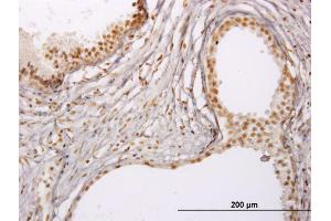 Immunoperoxidase of monoclonal antibody to RUNX1 on formalin-fixed paraffin-embedded human prostate.