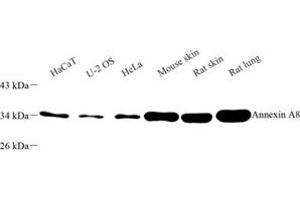 Western blot analysis of Annexin-A8 (ABIN7073071) at dilution of 1: 500 (Annexin VIII anticorps)