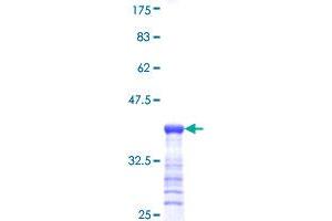 RGS5 Protein (AA 94-181) (GST tag)