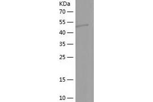 Western Blotting (WB) image for LIM Homeobox 4 (LHX4) (AA 124-390) protein (His-IF2DI Tag) (ABIN7123764)