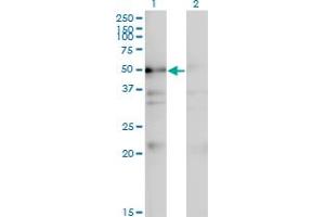 Western Blot analysis of NADK expression in transfected 293T cell line by NADK monoclonal antibody (M01), clone 5F4. (NADK anticorps  (AA 1-446))