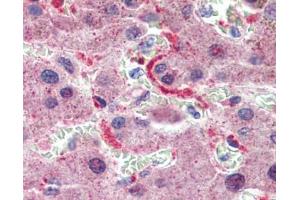 GPSM2 antibody was used for immunohistochemistry at a concentration of 4-8 ug/ml.