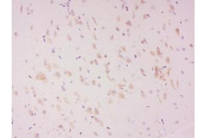 Formalin-fixed and paraffin embedded rat brain labeled with Anti-LATS2 (Ser83) Polyclonal Antibody, Unconjugated  at 1:300 followed by conjugation to the secondary antibody and DAB staining.