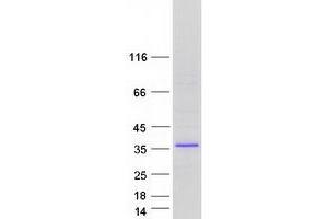 Validation with Western Blot