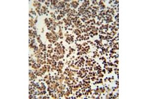 Immunohistochemistry analysis in formalin fixed and paraffin embedded human lymph tissue reacted with GTSF1 Antibody (Center) Cat. (GTSF1 anticorps  (Middle Region))