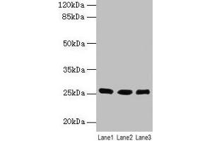 Western blot All lanes: LIN7A antibody at 6 μg/mL Lane 1: Human placenta tissue Lane 2: Mouse kidney tissue Lane 3: Mouse liver tissue Secondary Goat polyclonal to rabbit IgG at 1/10000 dilution Predicted band size: 26 kDa Observed band size: 26 kDa (LIN7A anticorps  (AA 1-233))