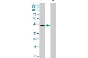 Lane 1: CDK4 transfected lysate ( 33. (CDK4 293T Cell Transient Overexpression Lysate(Denatured))