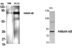 Western Blot (WB) analysis of specific cells using Adducin alpha/beta Polyclonal Antibody. (Adducin alpha/beta (Lys5) anticorps)