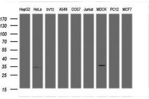 Image no. 2 for anti-Low Density Lipoprotein Receptor Adaptor Protein 1 (LDLRAP1) antibody (ABIN1496693) (LDLRAP1 anticorps)
