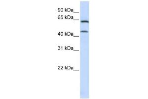 CHGN antibody used at 1 ug/ml to detect target protein. (CSGALNACT1 anticorps  (C-Term))
