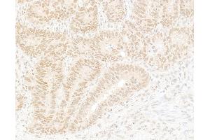 Immunohistochemistry (IHC) image for anti-K(lysine) Acetyltransferase 8 (KAT8) (AA 1-50) antibody (ABIN7454709) (MYST1 anticorps  (AA 1-50))