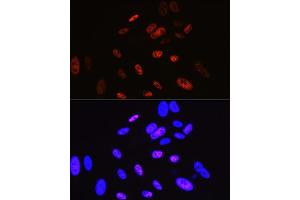 Immunofluorescence analysis of U-2 OS cells using Cyclin H Rabbit mAb (ABIN7266569) at dilution of 1:100 (40x lens).