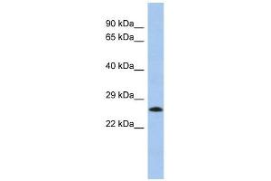 MGC50273 antibody used at 1 ug/ml to detect target protein. (MGC50273 (N-Term) anticorps)