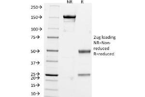 SDS-PAGE Analysis of Purified Chromogranin A Monoclonal Antibody (CHGA/765). (Chromogranin A anticorps)