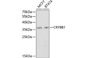 Western blot analysis of extracts of various cell lines, using CRYBB1 antibody  at 1:1000 dilution. (CRYBB1 anticorps  (AA 1-252))