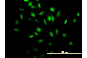 Immunofluorescence of purified MaxPab antibody to Rgr on HeLa cell. (RGL4 anticorps  (AA 1-410))