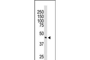 Western blot analysis of anti-DOK2 Pab in 174xCEM cell lysate (DOK2 anticorps  (C-Term))