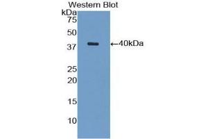 Detection of recombinant VCAM1 using Polyclonal Antibody to Vascular Cell Adhesion Molecule 1 (VCAM1)