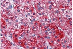 Human Adrenal: Formalin-Fixed, Paraffin-Embedded (FFPE)