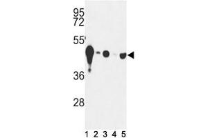 Western blot analysis of NSE antibody and (1) mouse cerebellum tissue and (2) Y79, (3) HepG2, (4) Jurkat and (5) CEM lysate.
