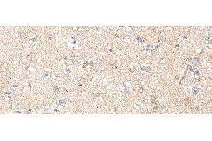 Immunohistochemistry of paraffin-embedded Human brain tissue using PNPO Polyclonal Antibody at dilution of 1:30(x200)