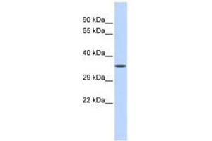 Image no. 1 for anti-Zinc Finger Protein 124 (ZNF124) (C-Term) antibody (ABIN6740539) (ZNF124 anticorps  (C-Term))