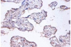 Immunohistochemistry of paraffin-embedded human placenta tissue using ABIN7148312 at dilution of 1:100 (COMMD4 anticorps  (AA 1-195))