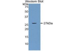 Western Blotting (WB) image for anti-CD79b Molecule, Immunoglobulin-Associated beta (CD79B) (AA 26-225) antibody (ABIN1859293) (CD79b anticorps  (AA 26-225))